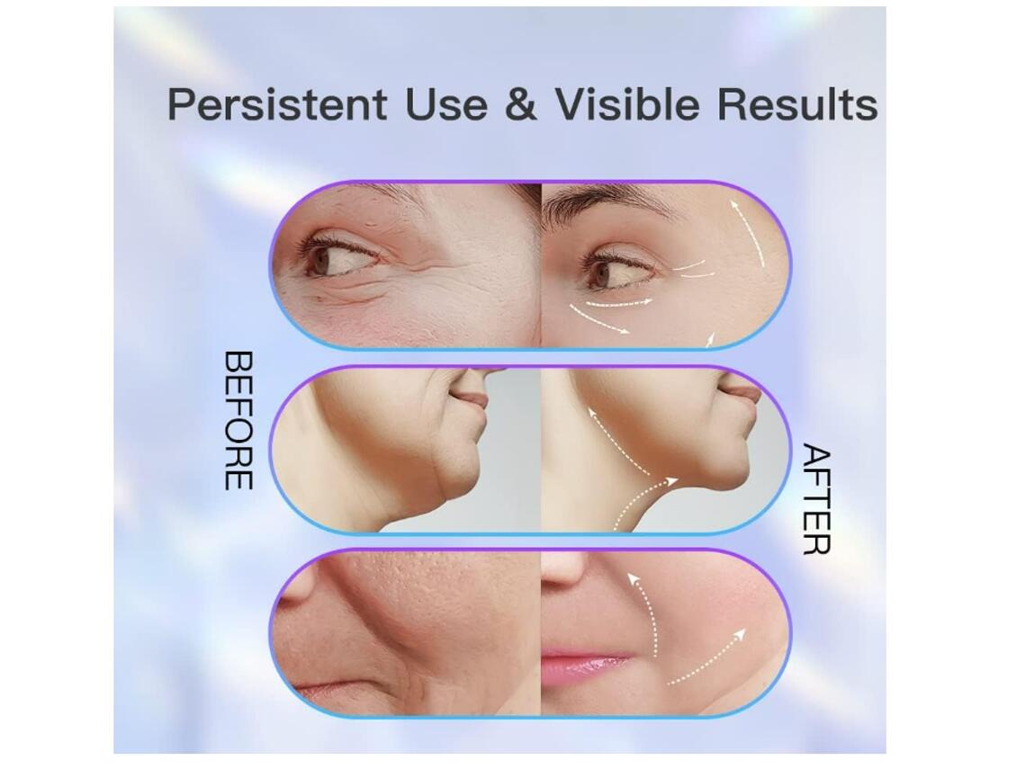Dispositivo Facial EMS con Limpieza Profunda y 3 Modos LED – Efecto Lifting Inmediato